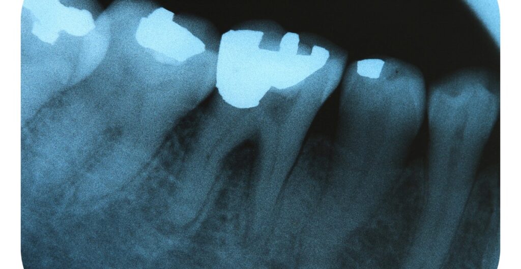 raio x odontologico