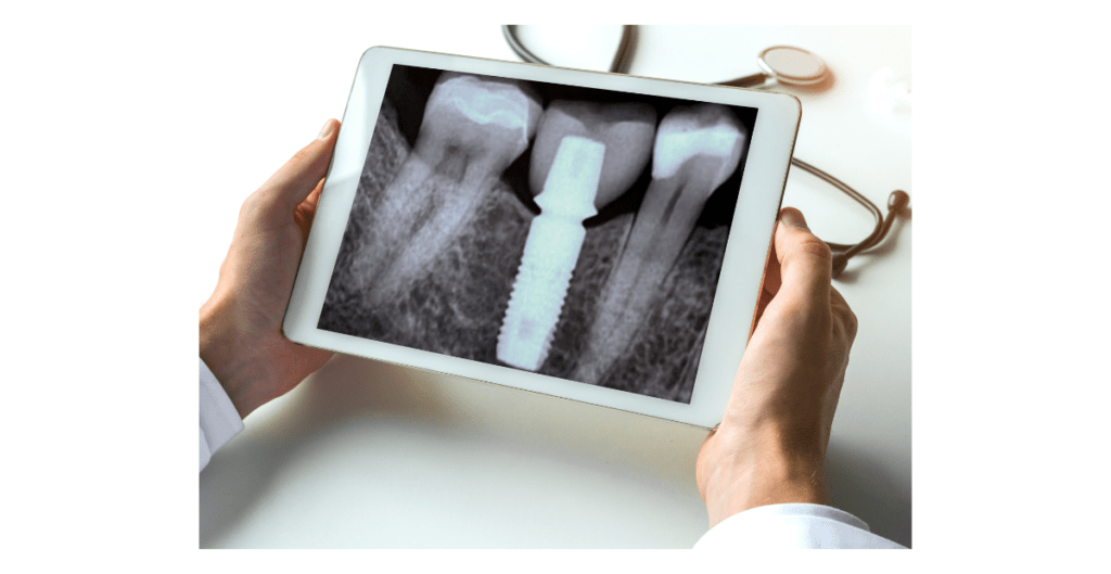 exame odontologico digital