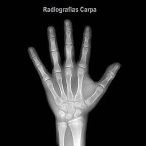 carpal