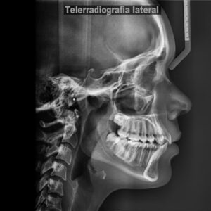 teleradiografia
